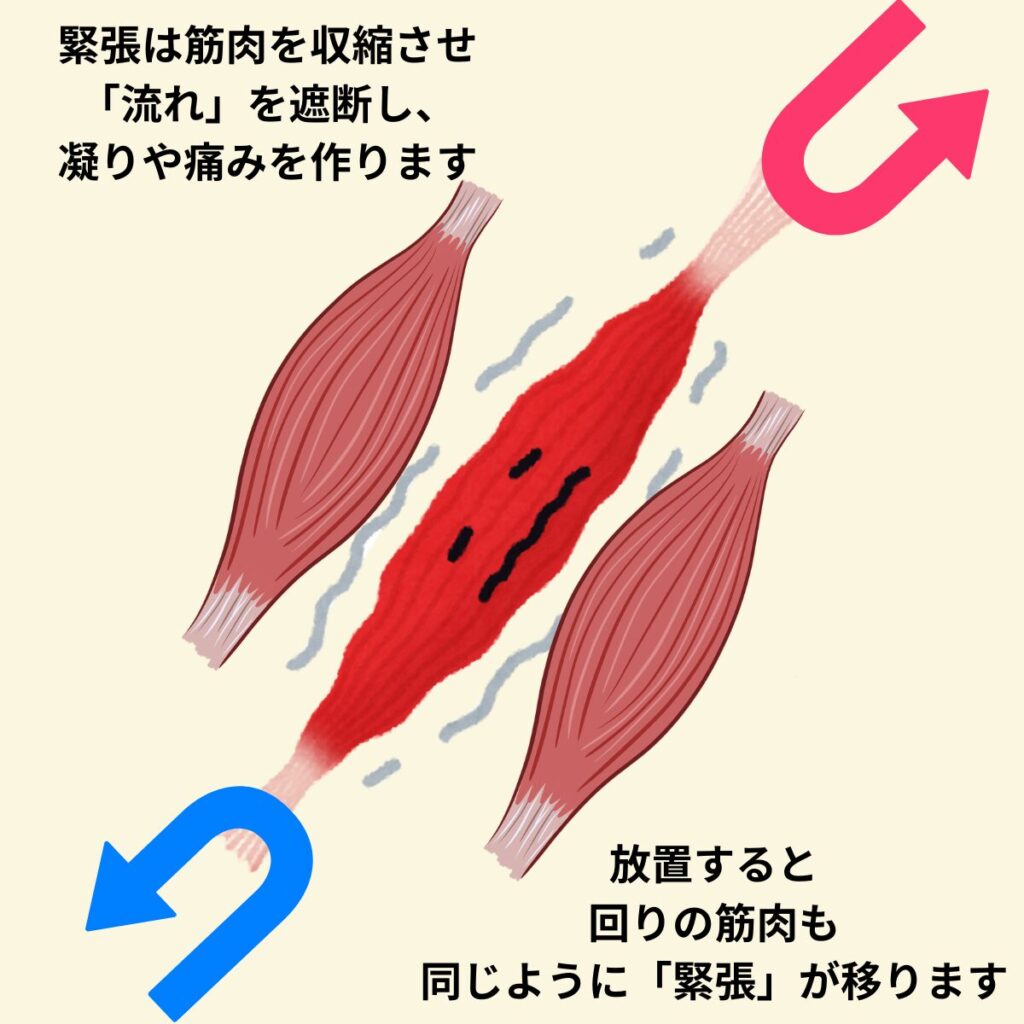 緊張は流れを遮断する。放置すると周りに広がる